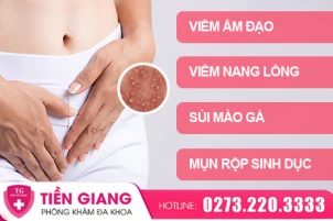 mun-o-mep-vung-kin-chuyen-te-nhi-nhung-khong-hiem-gap-1455