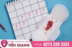 mat-kinh-keo-dai-co-dang-lo-khong-cach-khac-phuc-1408