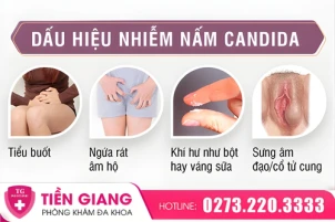 nam-candida-vung-kin-co-lay-khong-su-that-ban-can-biet-1438