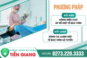 dot-viem-lo-tuyen-co-tu-cung-bang-laser-co-hieu-qua-khong-1165