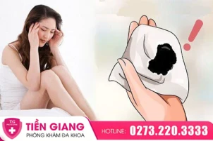 ra-dich-den-keo-dai-o-nu-gioi-canh-bao-dieu-gi-1417