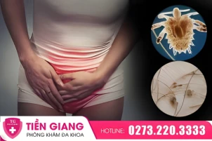 ngua-vung-kin-ban-dem-canh-bao-ran-mu-vung-kin-o-nu-gioi-1443