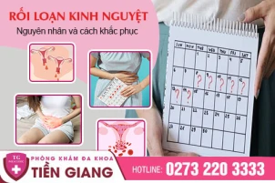 roi-loan-kinh-nguyet-bieu-hien-cua-benh-ly-va-phuong-phap-khac-phuc-765
