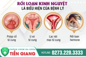 kinh-nguyet-ra-nhieu-ngay-co-nen-lo-lang-khong-cach-cai-thien-hieu-qua-1114