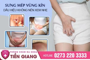 sung-mep-vung-kin-la-bi-gi-nguyen-nhan-va-cach-xu-ly-1397