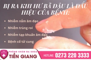dung-chu-quan-voi-khi-hu-ba-dau-giai-phap-an-toan-cho-chi-em-1485
