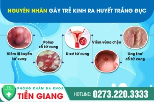 tre-kinh-ra-huyet-trang-duc-la-dau-hieu-gi-nguyen-nhan-va-khac-phuc-ra-sao-1223