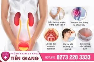 viem-nieu-dao-o-nu-phat-hien-som-giup-dieu-tri-nhe-nhang-1426