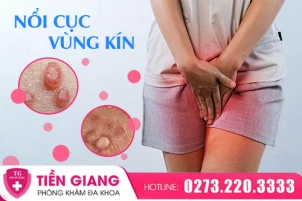 vung-kin-noi-cuc-la-dau-hieu-khong-nen-bo-qua-1429