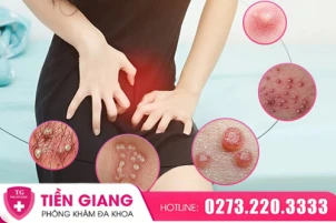 am-dao-noi-hot-dau-hieu-sinh-ly-hay-canh-bao-benh-ly-1431