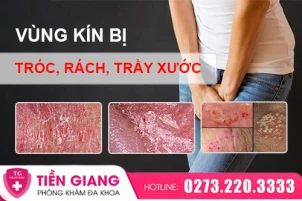 vung-kin-bi-troc-rach-tray-xuoc-dau-hieu-ton-thuong-hay-benh-ly-1449