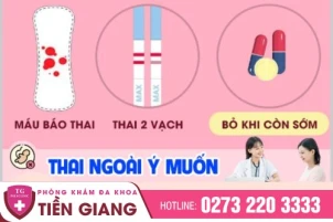 que-thu-thai-hien-thi-2-vach-la-sao-co-dang-mang-thai-khong-1382
