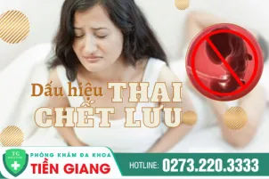 cach-xu-ly-thai-chet-luu-an-toan-cho-me-485