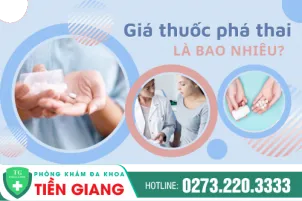 gia-tien-thuoc-pha-thai-tren-thi-truong-bay-gio-400