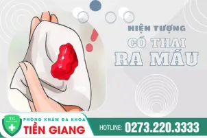 hieu-dung-ve-tinh-trang-co-thai-ra-mau-454