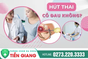 hut-thai-co-dau-khong-danh-cho-thai-bao-nhieu-tuan-393