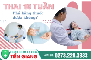 su-dung-thuoc-pha-thai-10-tuan-phai-qua-chi-dinh-cua-bac-si-363