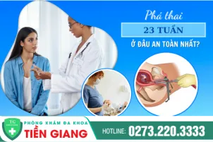 pha-thai-23-tuan-bang-cach-nao-254