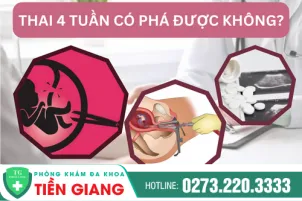 thai-4-tuan-co-pha-duoc-khong-nhung-luu-y-chi-em-can-biet-679