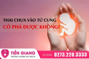 pha-thai-khi-thai-chua-vao-tu-cung-nen-hay-khong-1408