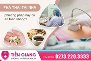 cach-pha-thai-tai-nha-nhung-dieu-khong-nen-chu-quan-1406