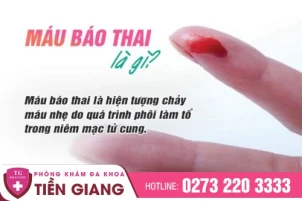 chuyen-gia-san-khoa-giai-thich-hien-tuong-mau-bao-thai-va-cach-xu-ly-an-toan-1384