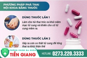 nen-uong-thuoc-ra-thai-trong-truong-hop-nao-huong-dan-pha-thai-bang-thuoc-an-toan-va-hieu-qua-886