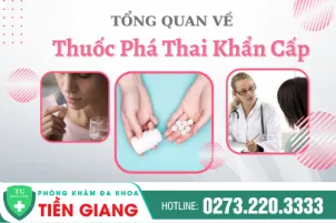 thuoc-pha-thai-khan-cap-gia-bao-nhieu-huong-dan-su-dung-222