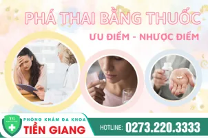 cac-uu-nhuoc-diem-khi-pha-thai-an-toan-bang-thuoc-410